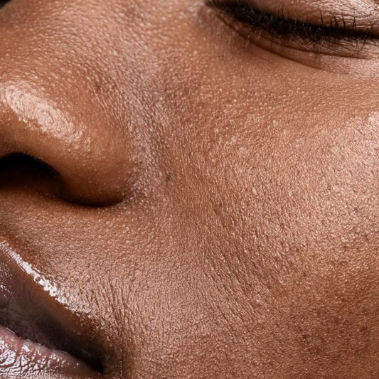Texture et pores dilatés